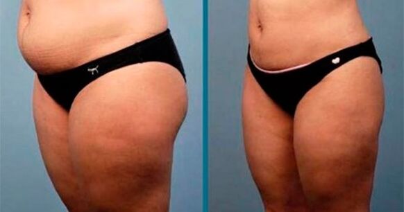 metodi per perdere peso di 10 chilogrammi in un mese